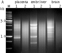 Typical cDNA normalization result
